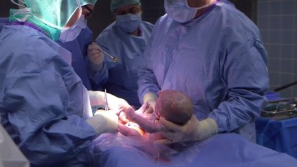 Immer mehr Babys kommen per Kaiserschnitt zur Welt